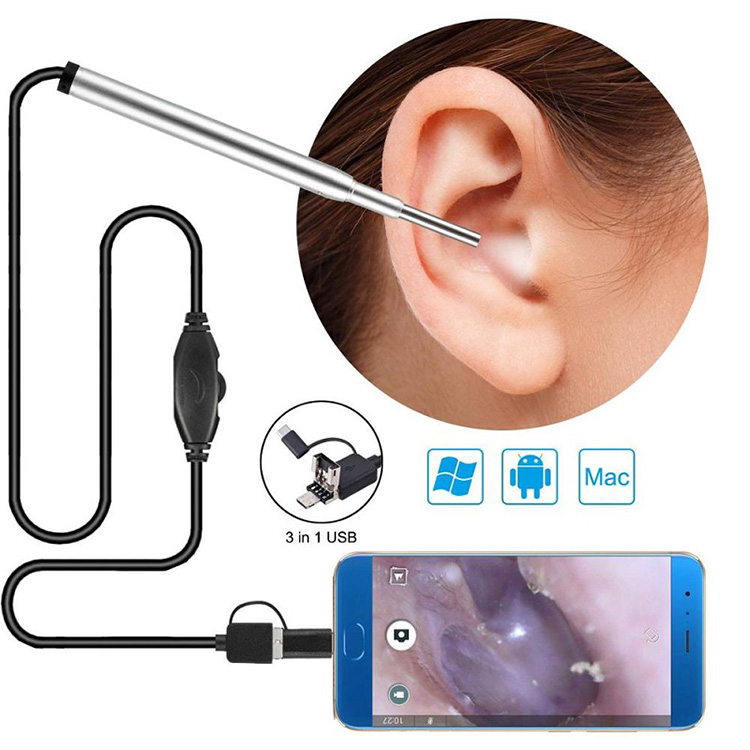 ဆေးဘက်ဆိုင်ရာ Endoscope ကင်မရာ Ear Nasal Endoscope Usb Otoscope